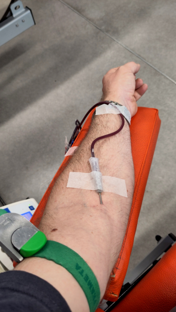 Foto van bloedafname: arm met een naald erin en een slang eraan.